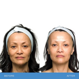 Bio Therapeutic Bt-sculpt