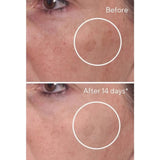 Murad Rapid Dark Spot Correcting Serum