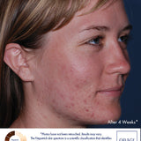 Obagi CLENZIderm MD Pore Therapy