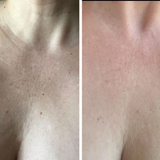 Omnilux Contour Neck & Decollete