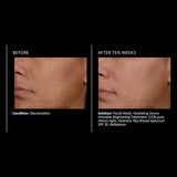PCA Skin Intensive Brightening Treatment 0.5% pure retinol