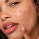 Dermalogica Clear Start Post-Breakout Fix