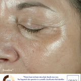 Obagi ELASTIderm Eye Cream