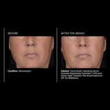 PCA Skin Intensive Brightening Treatment 0.5% pure retinol