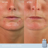 Vida Glow Clear Advanced Repair