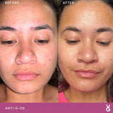Vida Glow Anti-G-Ox Mixed Trial Pack