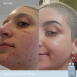 Vida Glow Clear Advanced Repair