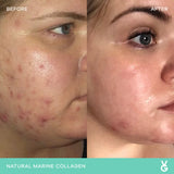 Vida Glow Natural Marine Collagen Sachets Original
