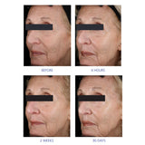 iS Clinical Youth Eye Complex