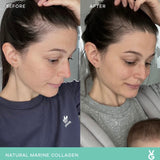 Vida Glow Natural Marine Collagen Trial Pack