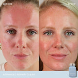 Vida Glow Clear Advanced Repair