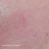 iS Clinical Active Serum