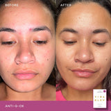 Vida Glow Anti-G-Ox Citrus