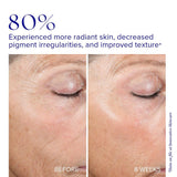 iS Clinical Active Peel System