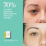 Vida Glow Natural Marine Collagen Sachets Pineapple