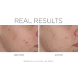Cosmedix Shineless Oil Free Moisturiser