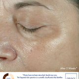 Obagi ELASTIderm Eye Cream