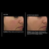 PCA Skin Dual Action Redness Relief