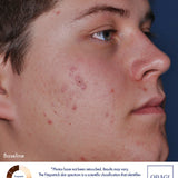 Obagi CLENZIderm MD Pore Therapy