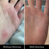 Omnilux Contour Glove