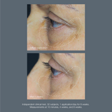 Dermalogica Awaken Peptide Eye Gel