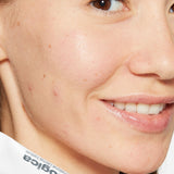 Dermalogica Deep Breakout Liquid Patch