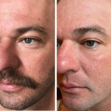 Omnilux Men