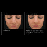 PCA Skin Intensive Clarity Treatment 0.5% pure retinol & salicylic acid