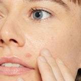 Dermalogica Deep Breakout Liquid Patch
