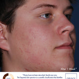 Obagi CLENZIderm MD Pore Therapy