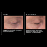 PCA Skin Ideal Complex restorative eye cream