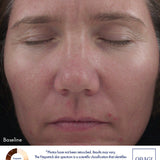 Obagi360 Retinol 1.0 Cream