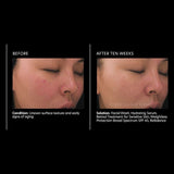 PCA Skin Retinol Treatment For Sensitive Skin