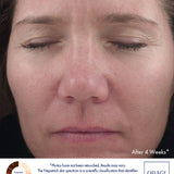 Obagi360 Retinol 1.0 Cream