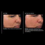 PCA Skin Intensive Age Refining Treatment 0.5% pure retinol